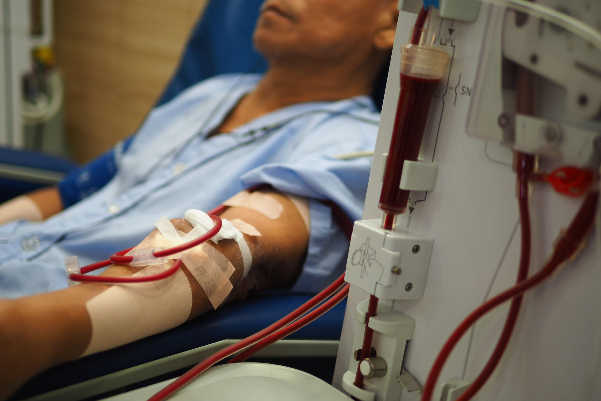 Dialysis
