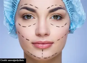 Plastic Surgery